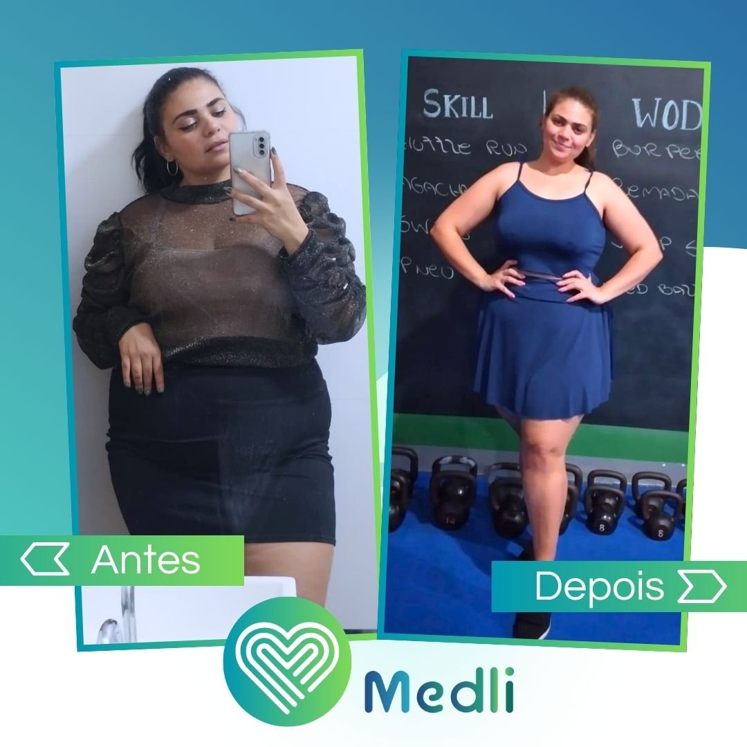 Transformação real de paciente após tratamento para perda de peso